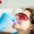 Professional Teeth Whitening in Allen Professional Teeth Whitening in Allen